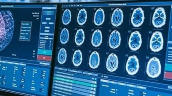  可穿戴睡眠监测十年：技术狂奔背后的诊断率悖论 IT技术